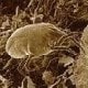 Dust Mite magnified